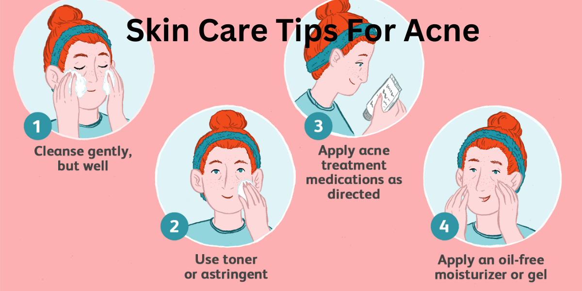 skin care tips for acne